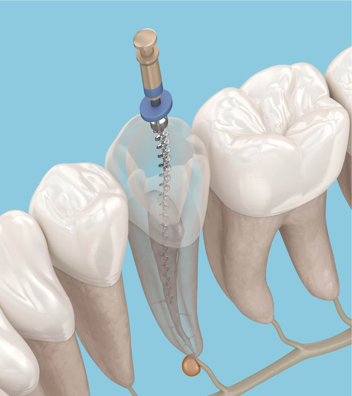 Tri Rooted Tooth Root Canal Tri Cities WA | Prime Dental Tri-Cities
