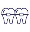 Braces